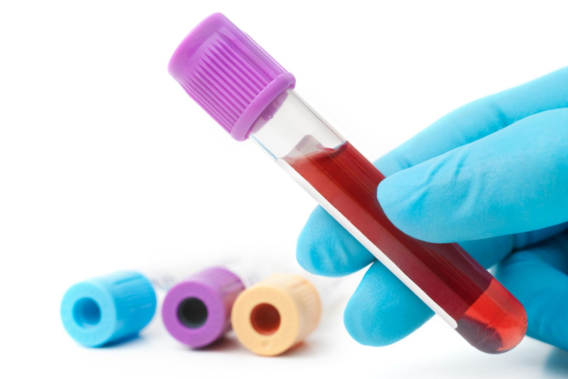 Blood testing & monitoring