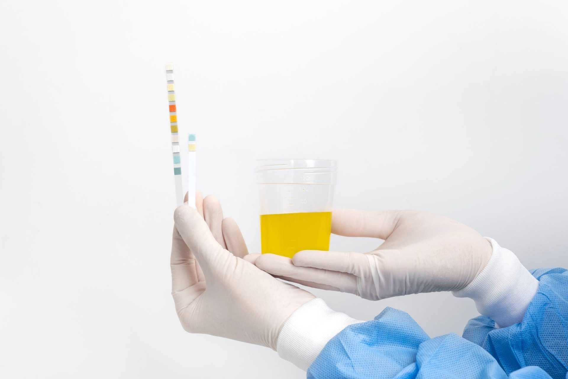 Urinalysis